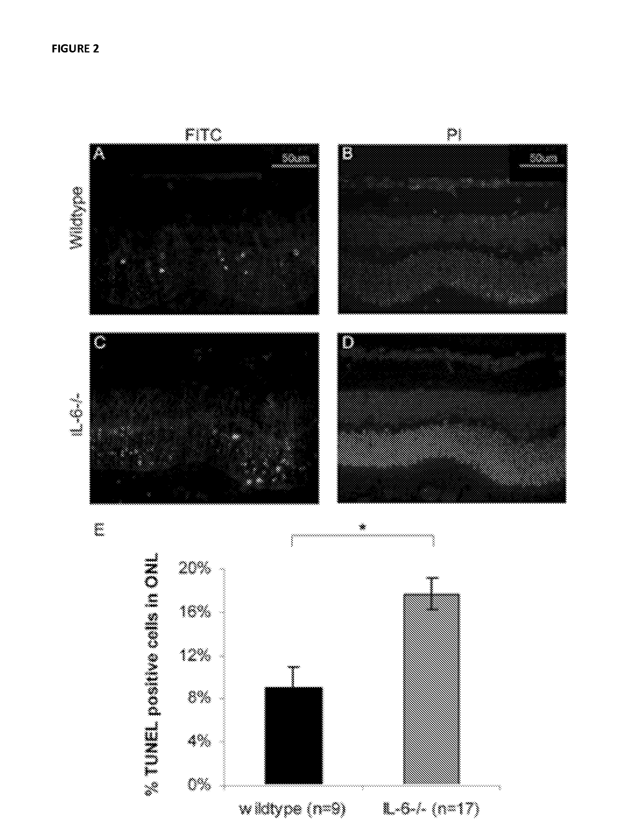 Methods of inhibiting photoreceptor apoptosis