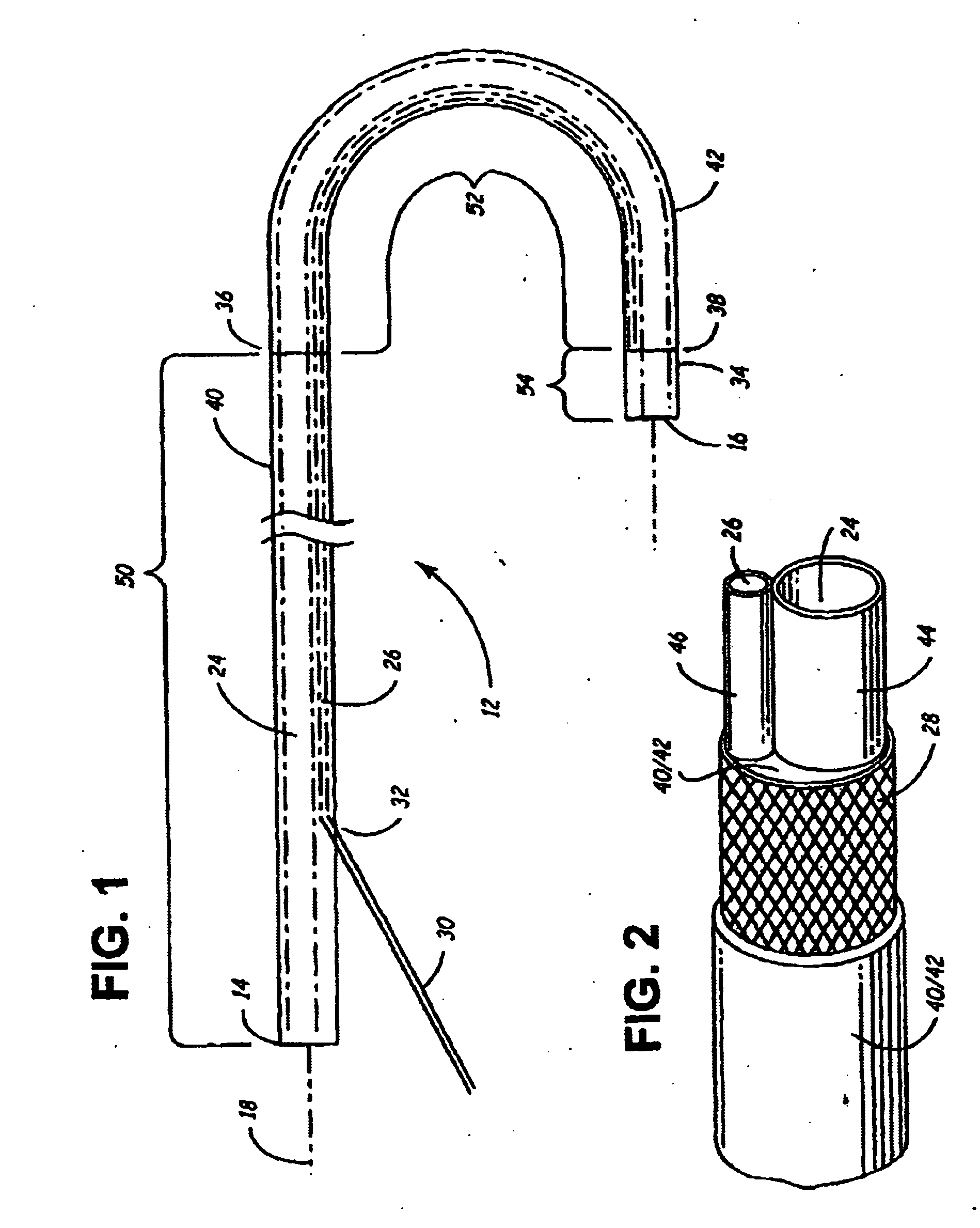 Methods and systems for accessing the pericardial space