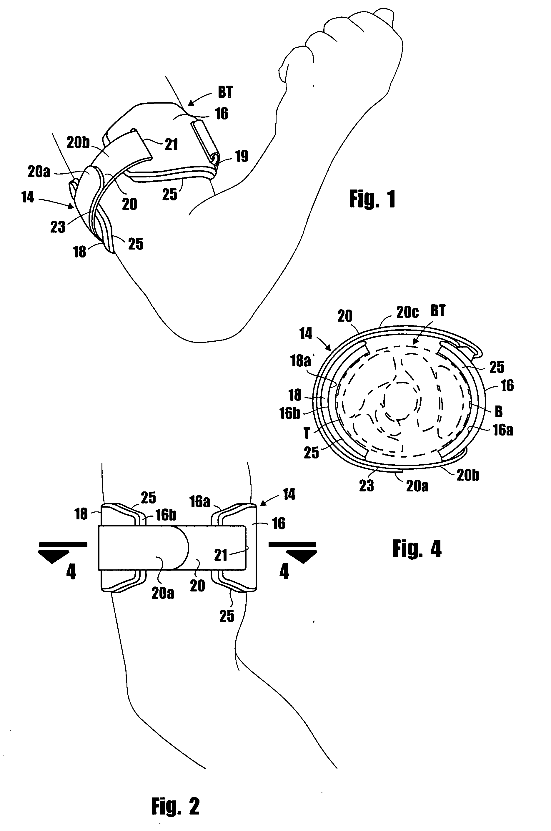 Apparatus for the treatment of arm disorders and the methods of using same