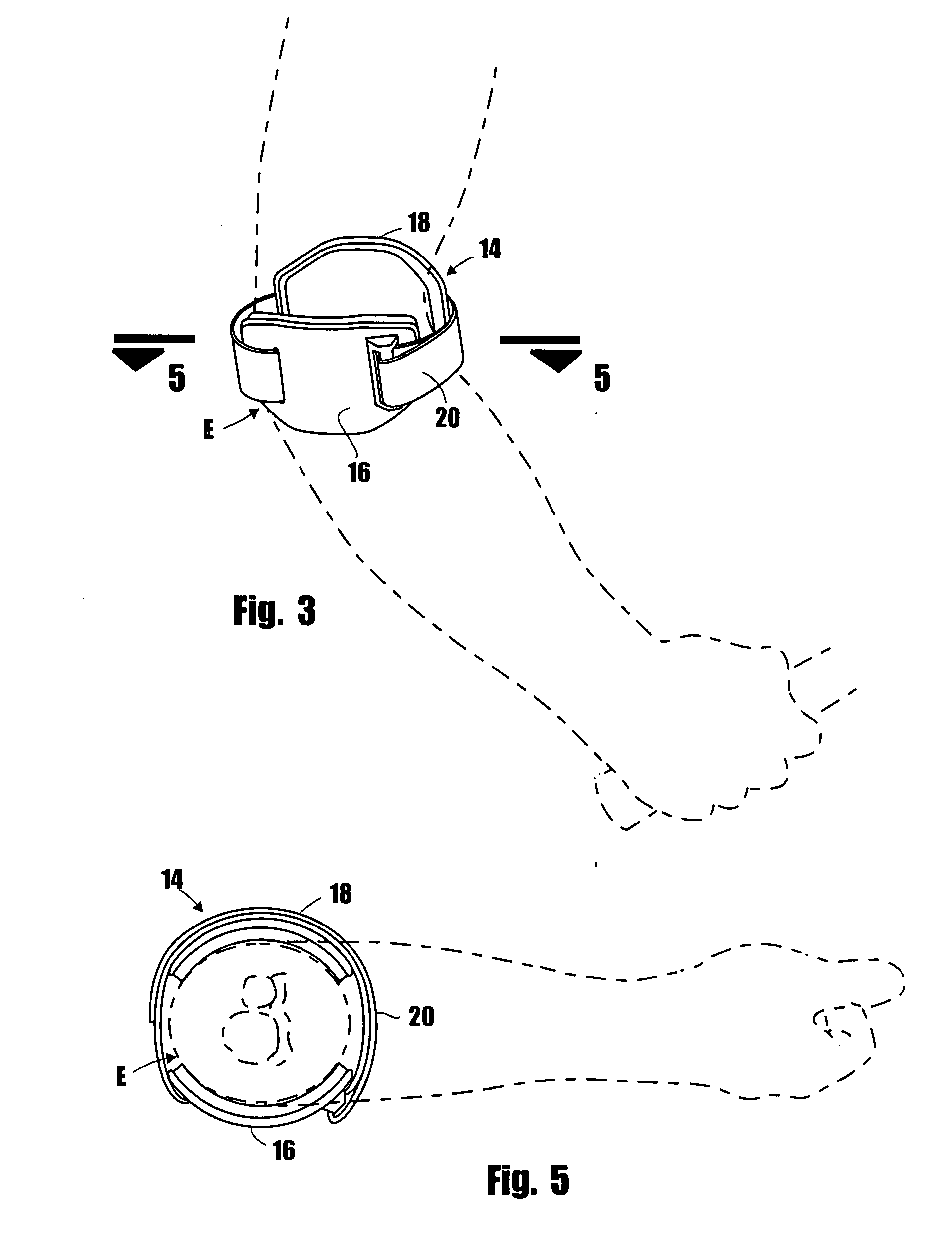 Apparatus for the treatment of arm disorders and the methods of using same