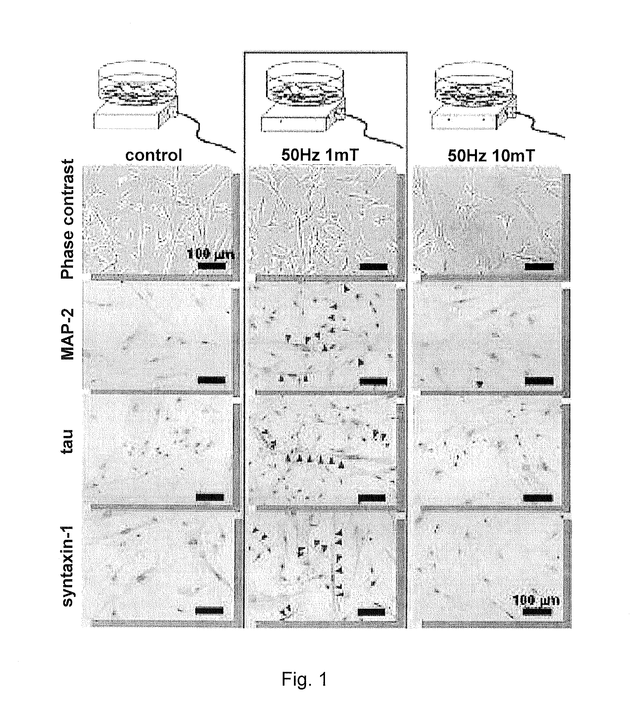 Method for inducing differentiation of adult stem cells and nerve cells using electromagnetic field
