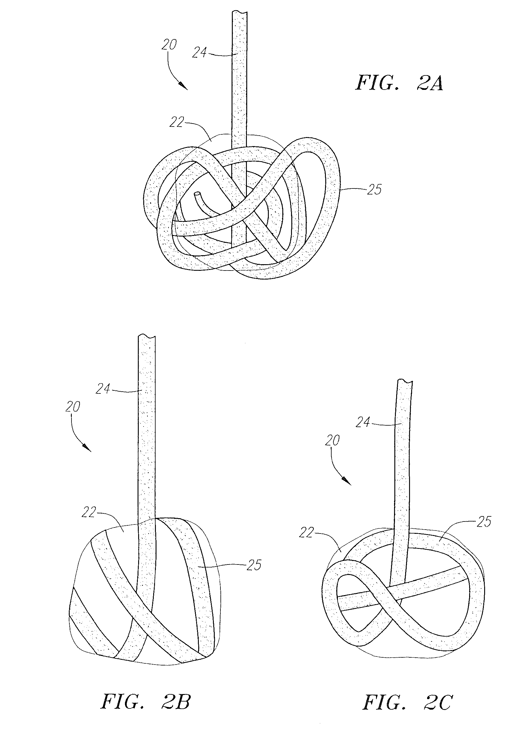 Vascular plug having composite construction