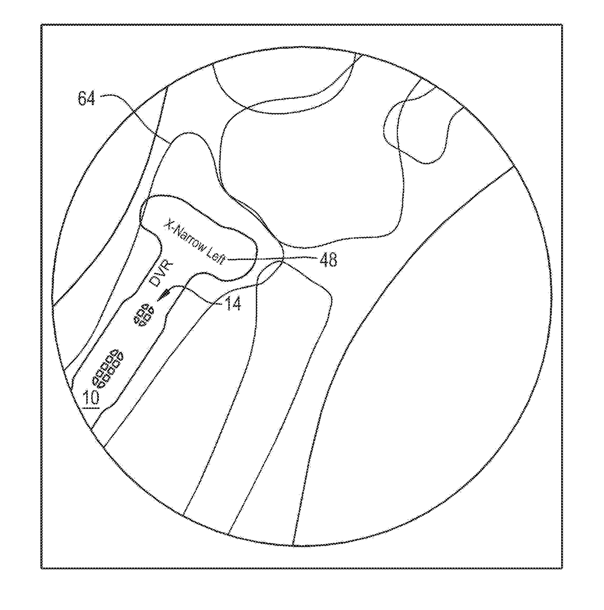 Orthopaedic implant template and method of making