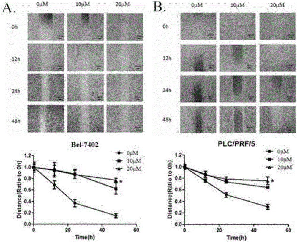 Applications of apigenin for preparation of medicines inhibiting liver cancer epithelial-mesenchymal transition