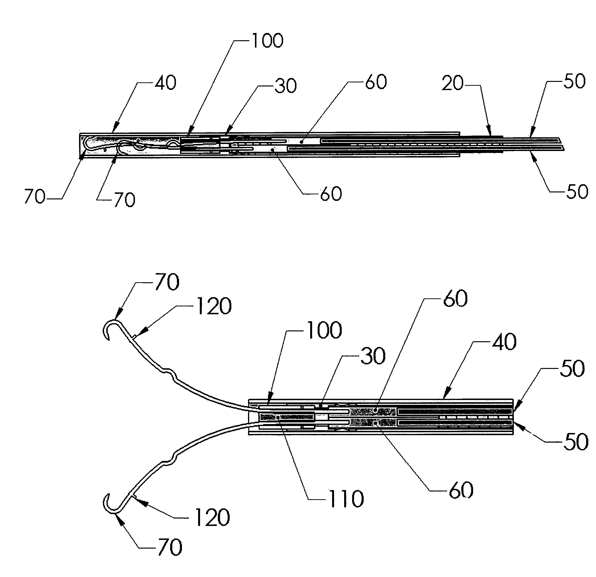 Endoscopic device with independently actuated legs