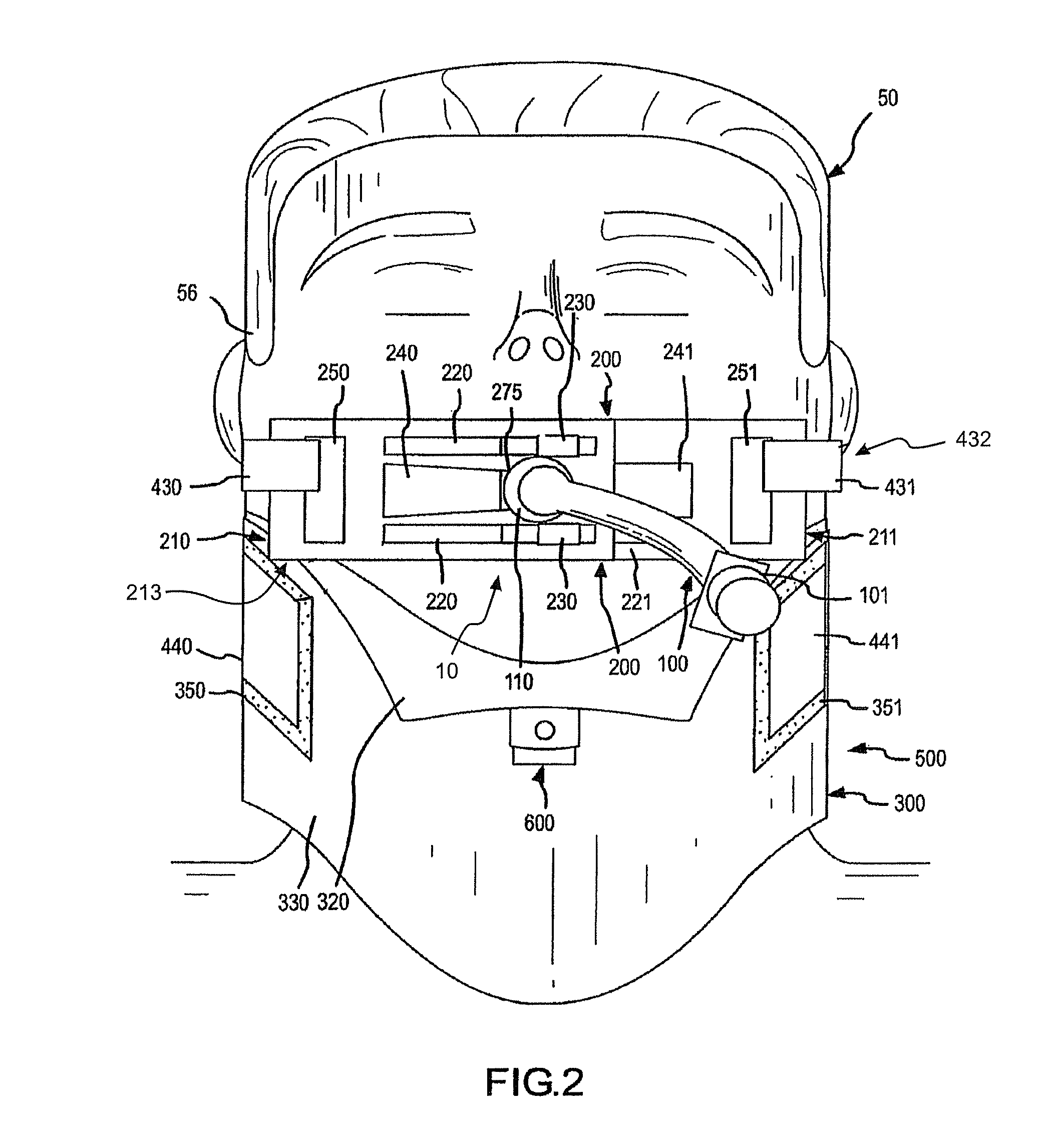 Complete airway stabilization system and method