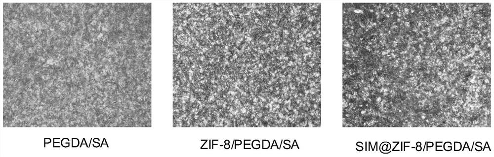 ZIF-8 drug-loaded hydrogel osteogenesis-promoting scaffold, preparation method and application