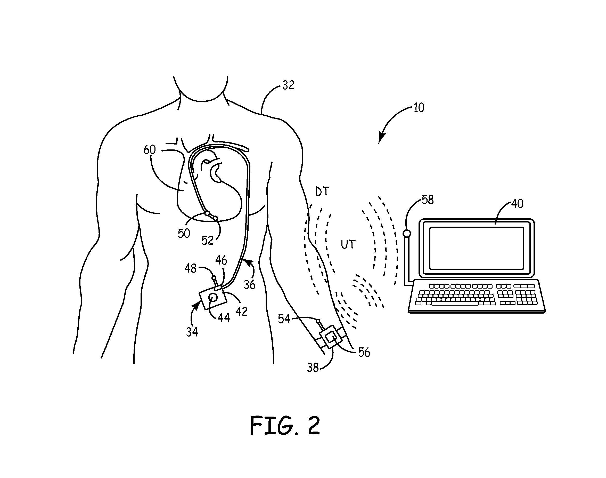 System and method for monitoring a ventricular pressure index to predict worsening heart failure