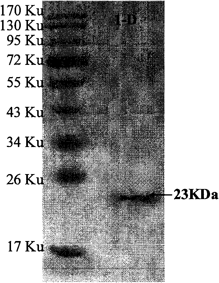 Monoclonal antibody resisting anaplasma marginale MSP5 protein and application thereof