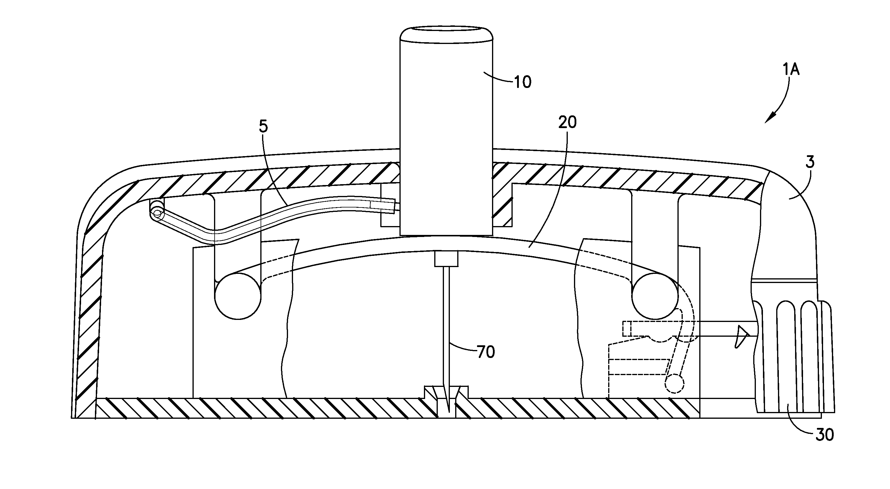 Cannula Insertion and Retraction Device for Infusion Device