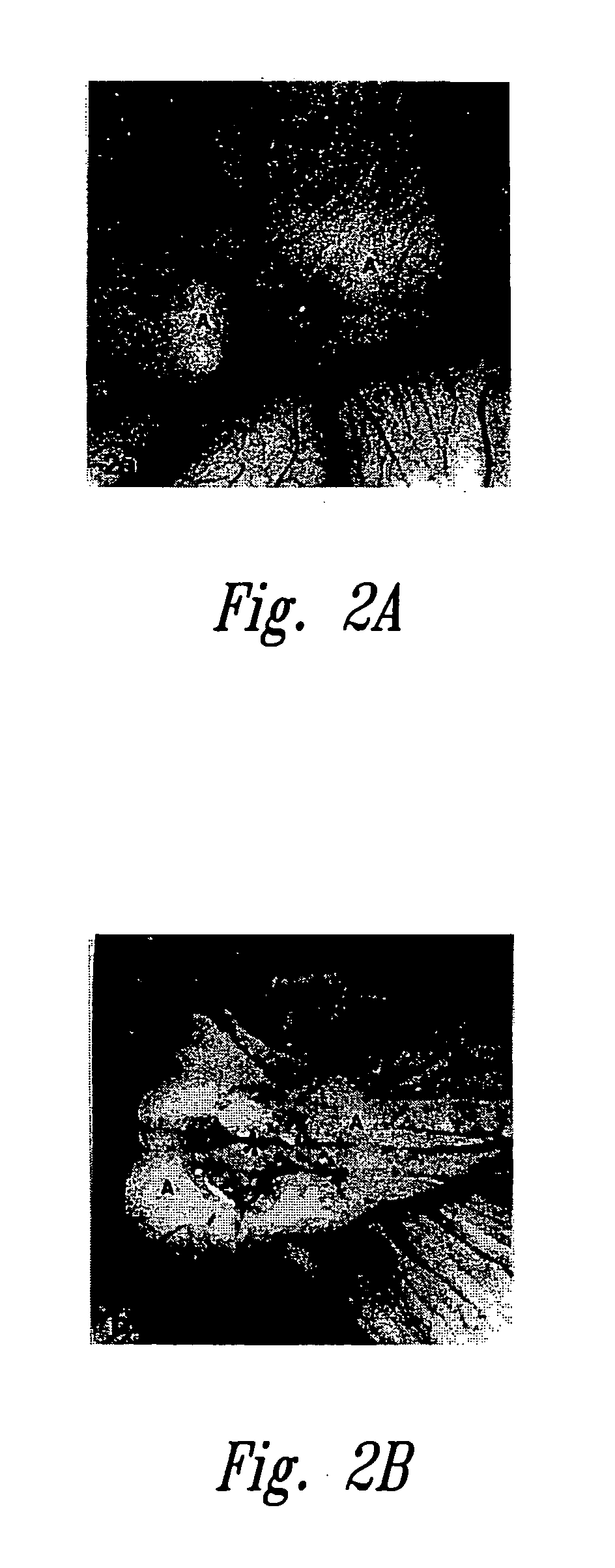 Anti-angiogenic compositions and methods of use