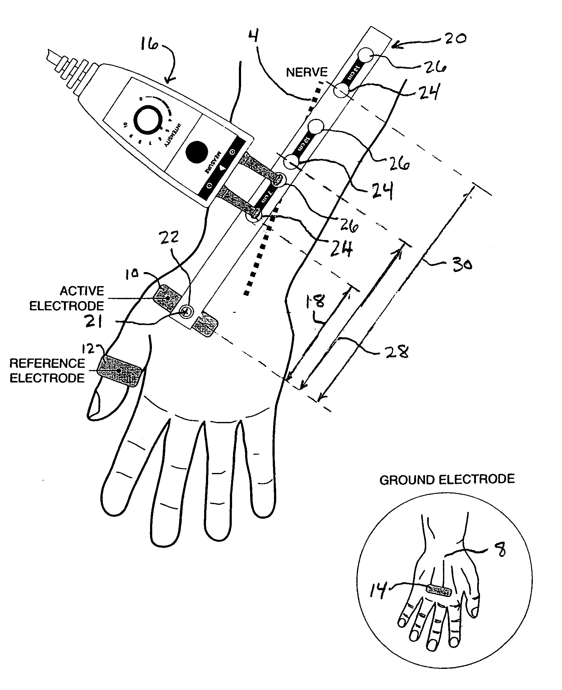 Apparatus for neuromuscular function signal acquisition