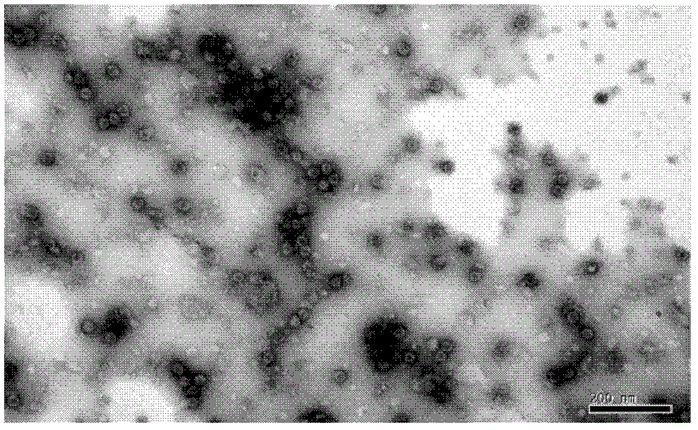 A16 type strain of Coxsackie virus and application of the strain