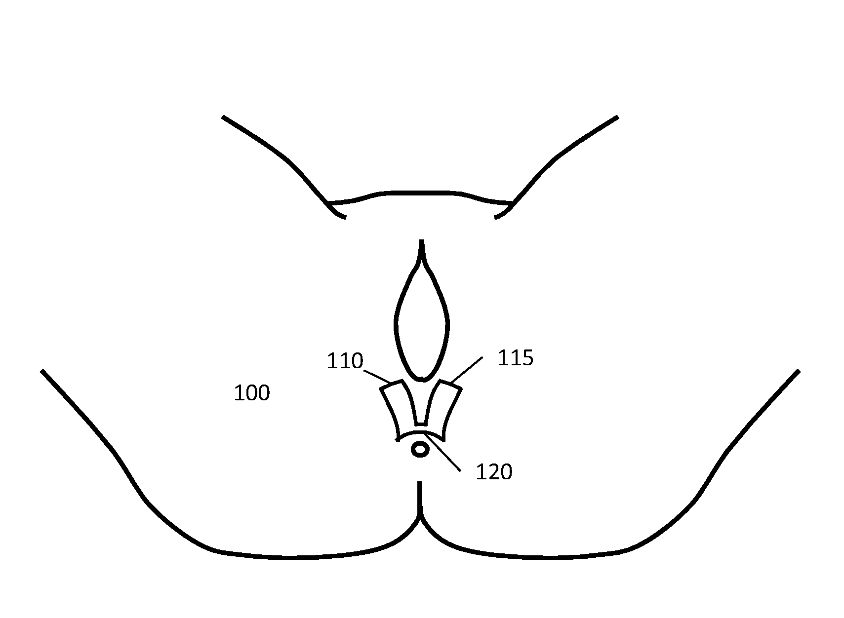 Device and Methods to Reduce Vaginal Tearing During Delivery