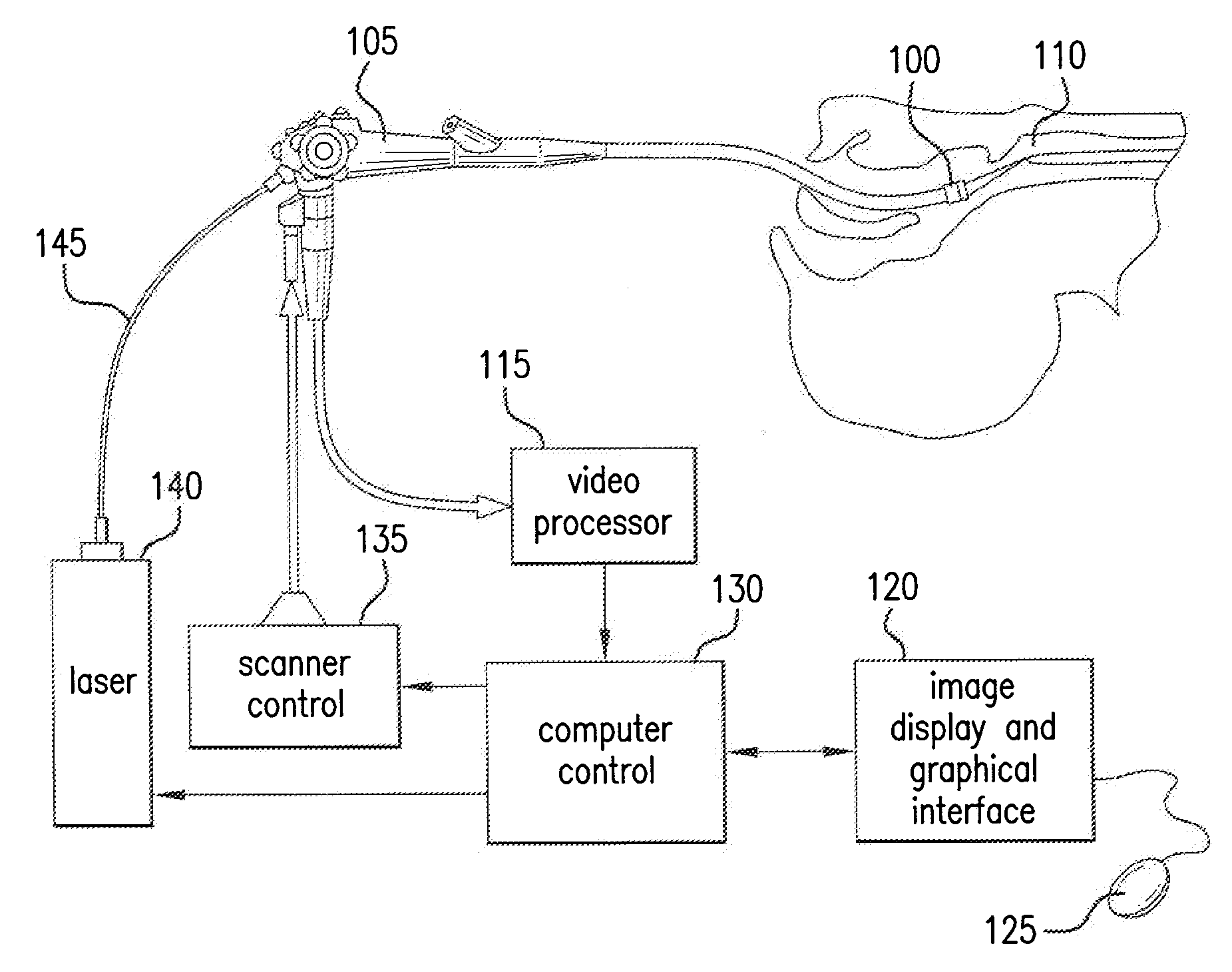 Apparatus, system and method for providing laser steering and focusing for incision, excision and ablation of tissue in minimally-invasive surgery