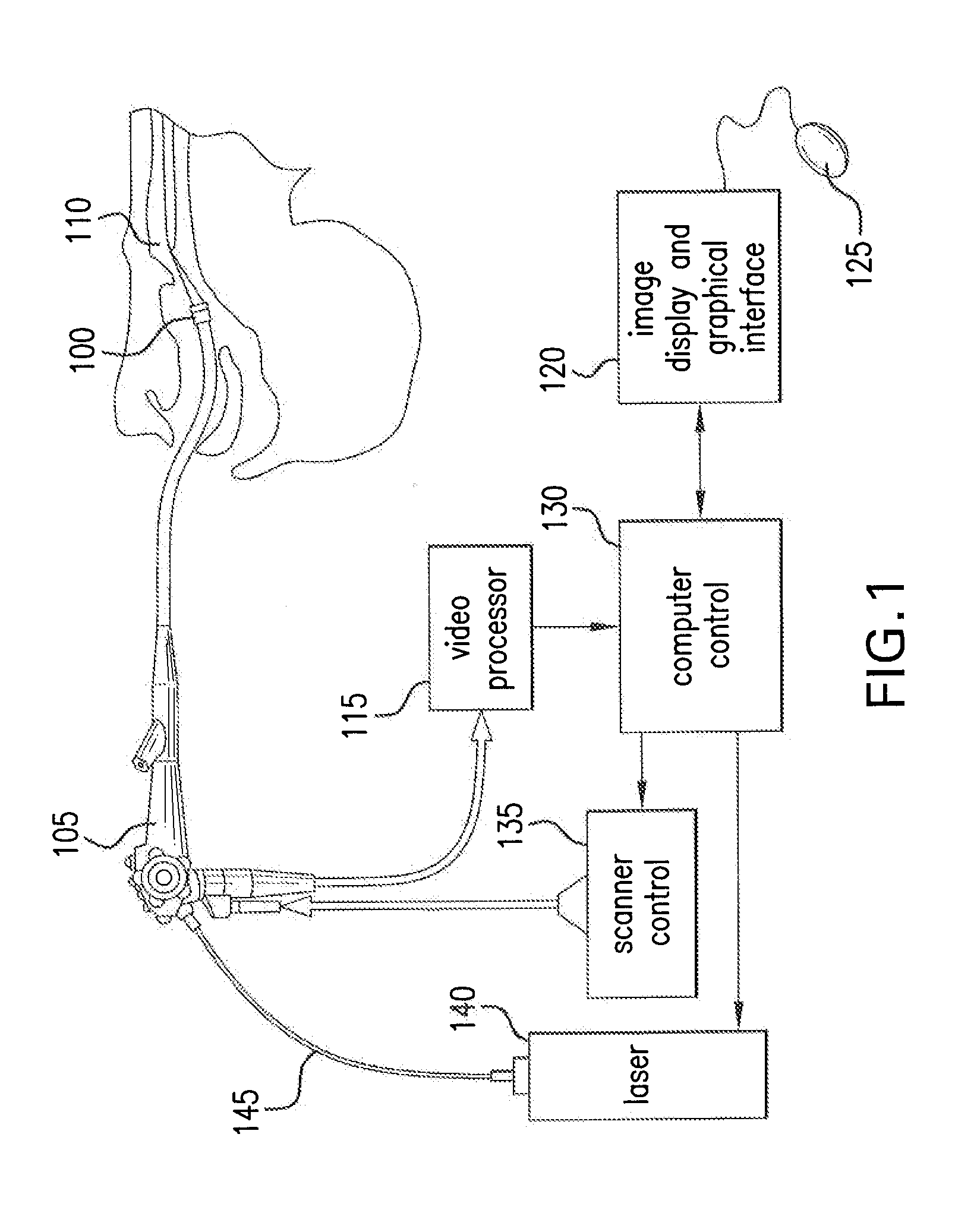 Apparatus, system and method for providing laser steering and focusing for incision, excision and ablation of tissue in minimally-invasive surgery