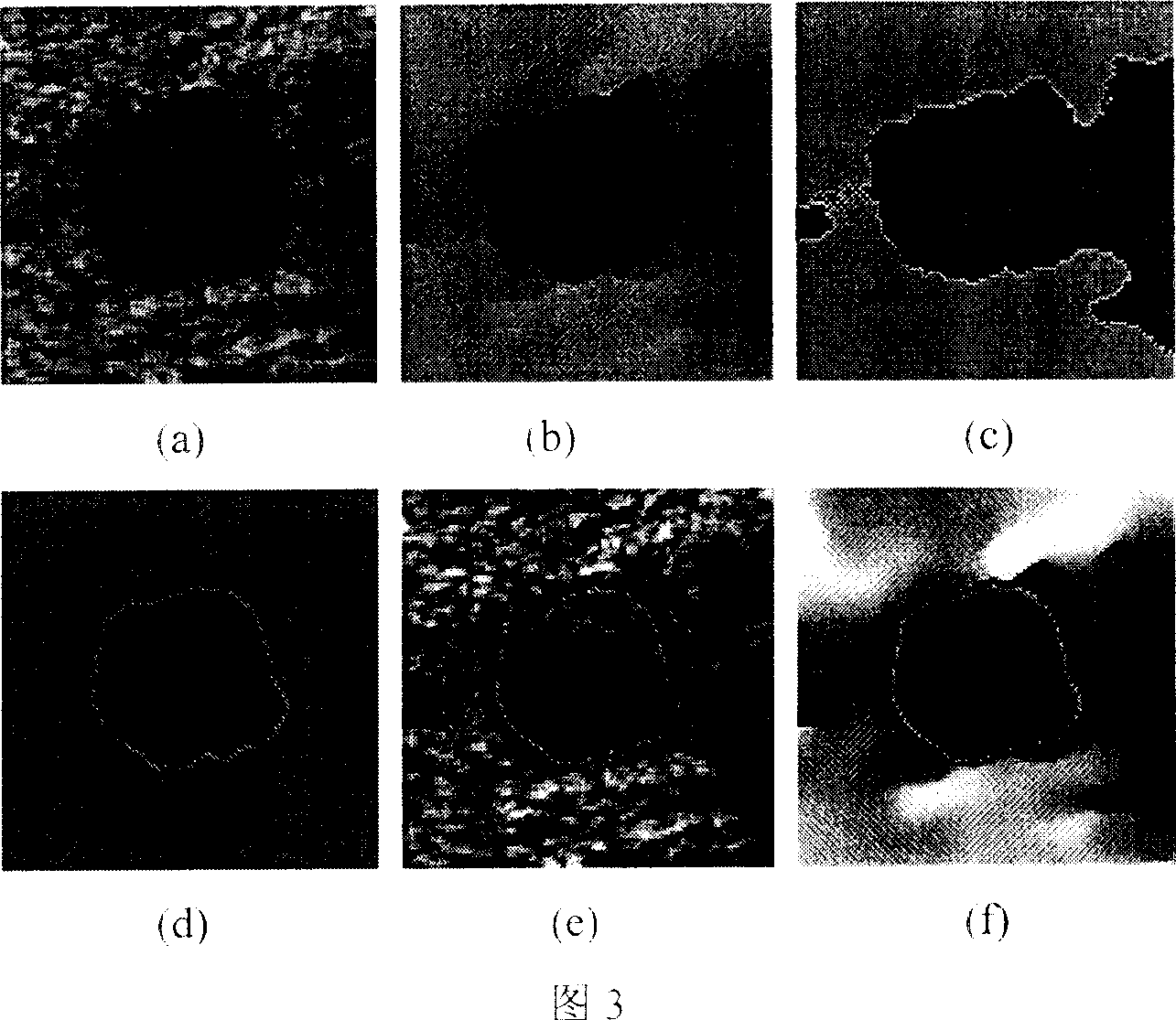 Two-dimensional blur polymer based ultrasonic image division method