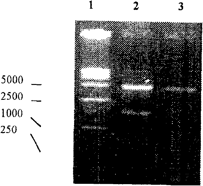 Fusion expressed product of vascular inhibine and endostatin in colibacillus and its preparing method