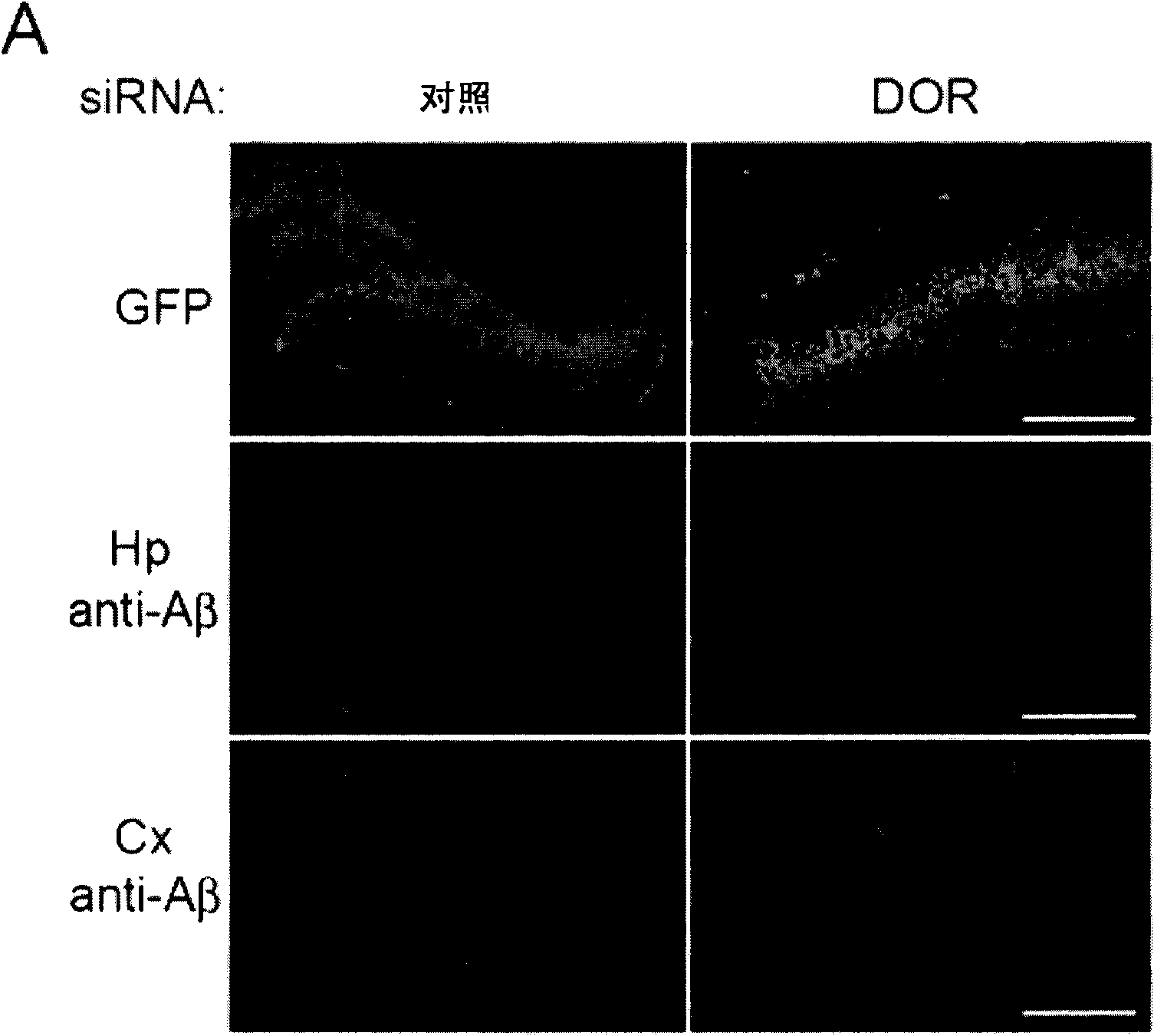 Application of delta opioid receptor antagonist to relief of Alzheimer's disease