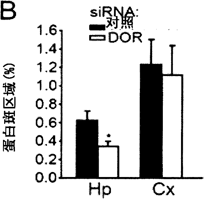 Application of delta opioid receptor antagonist to relief of Alzheimer's disease