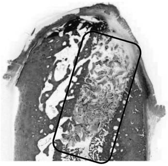 Osteoinductive regenerative film and its preparation method and application