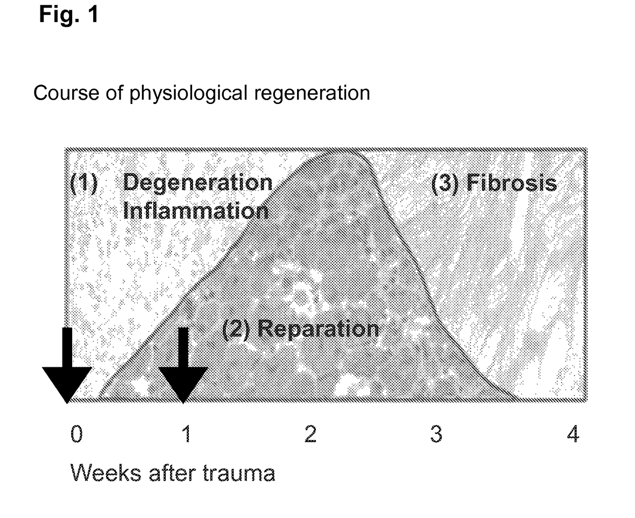 Skeletal muscle regeneration using mesenchymal system cells