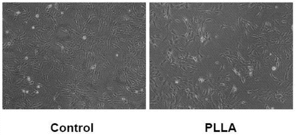 Method for inhibiting late endothelial progenitor cell function