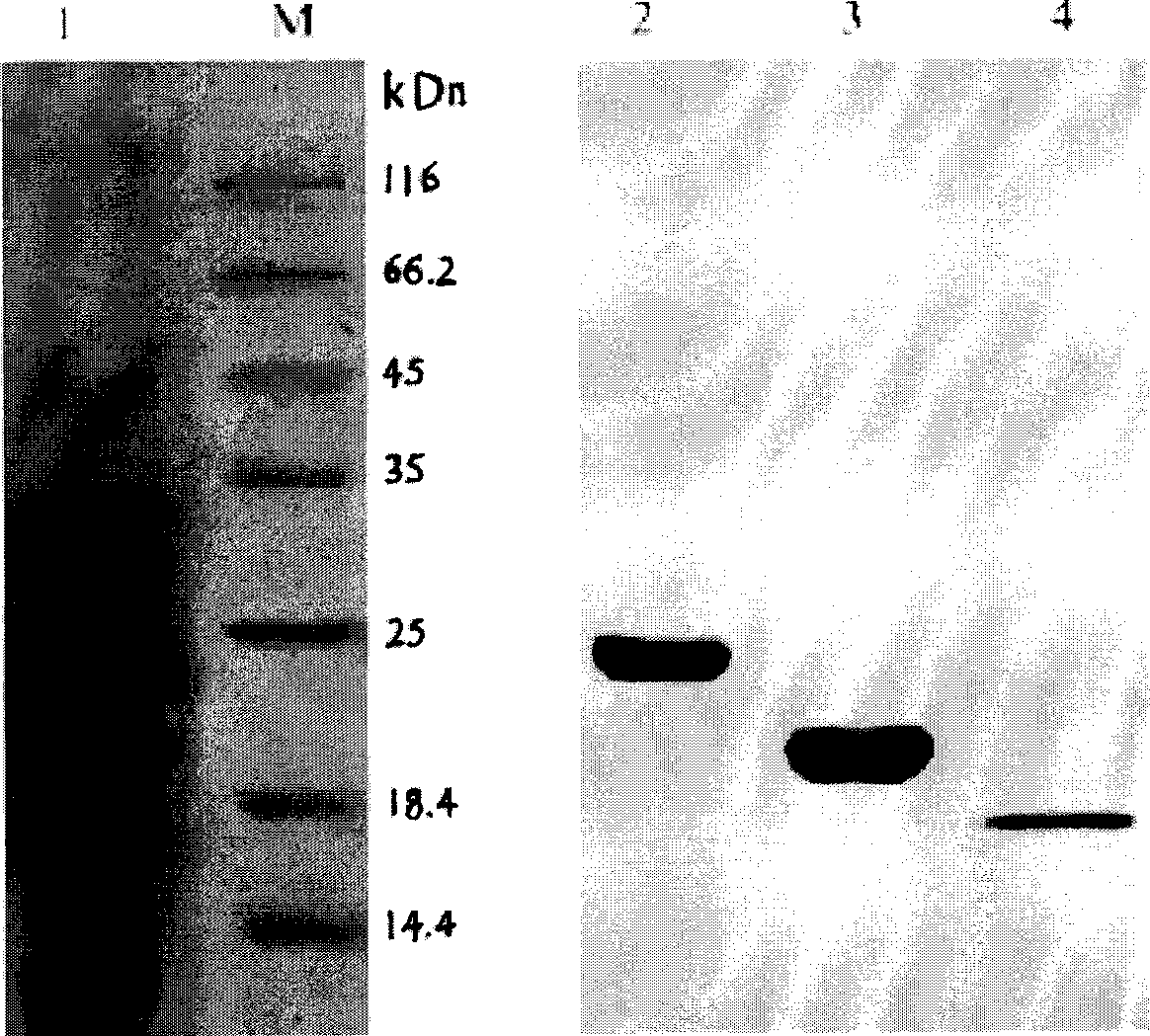 Polylactic acid degrading enzyme with protein degrading activity
