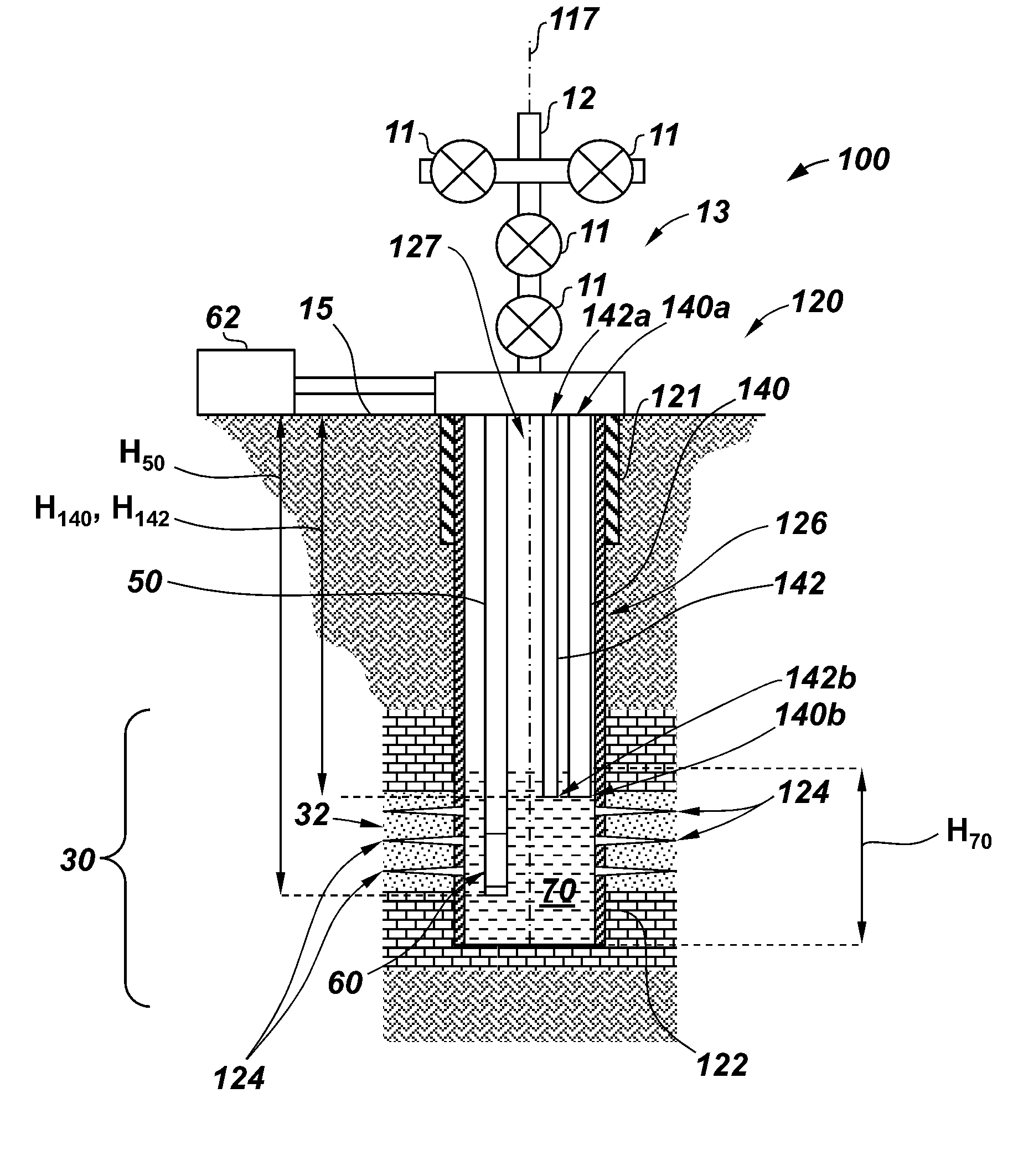 Systems and methods for production of gas wells