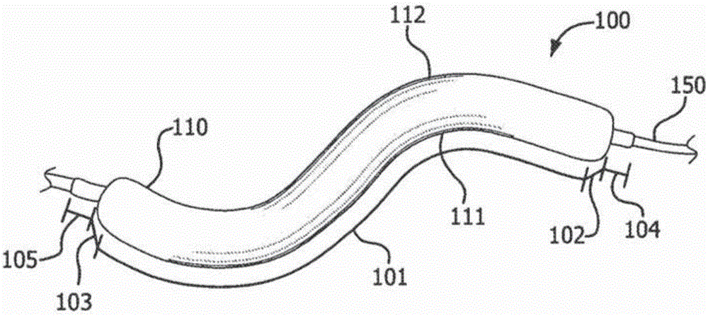 Conformable balloon devices and methods