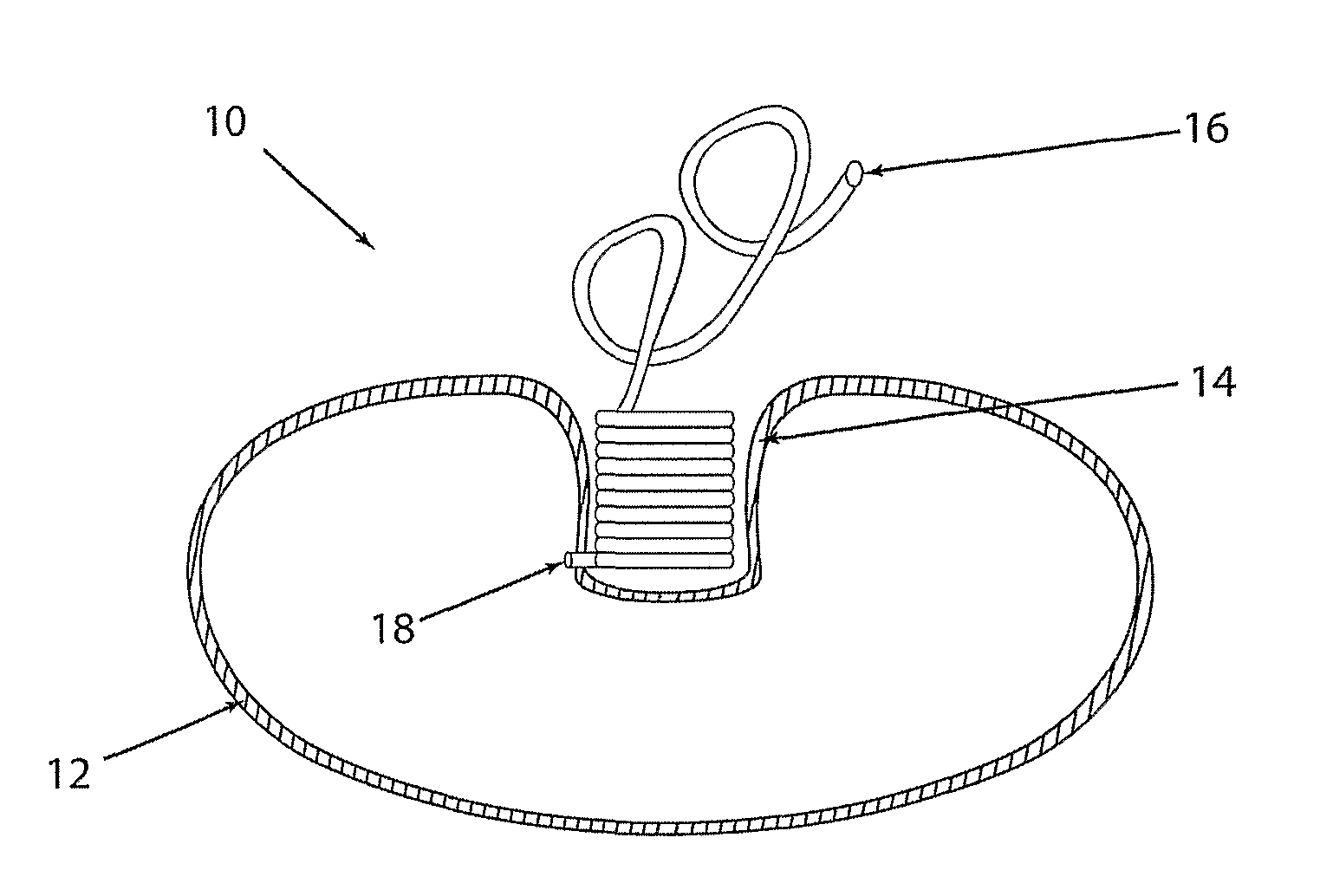 Apparatus and method for volume adjustment of intragastric balloons