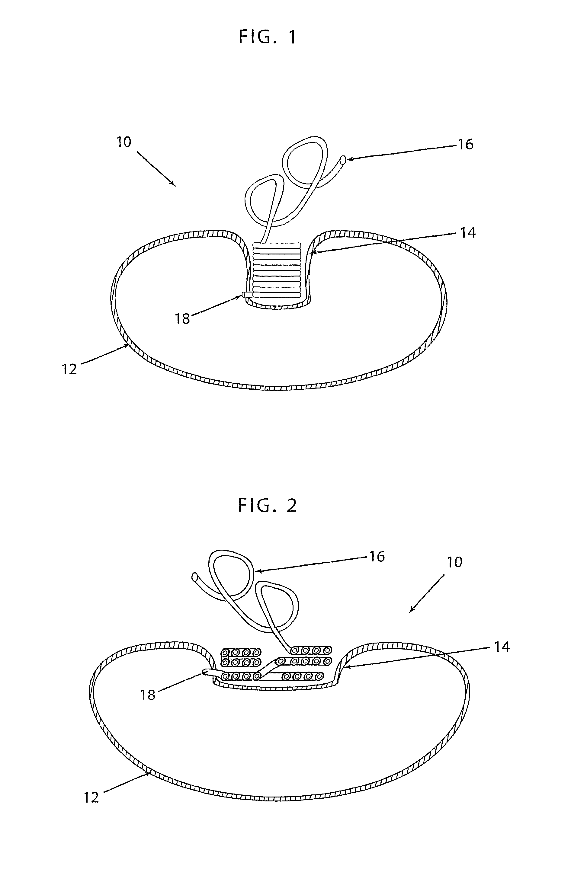 Apparatus and method for volume adjustment of intragastric balloons