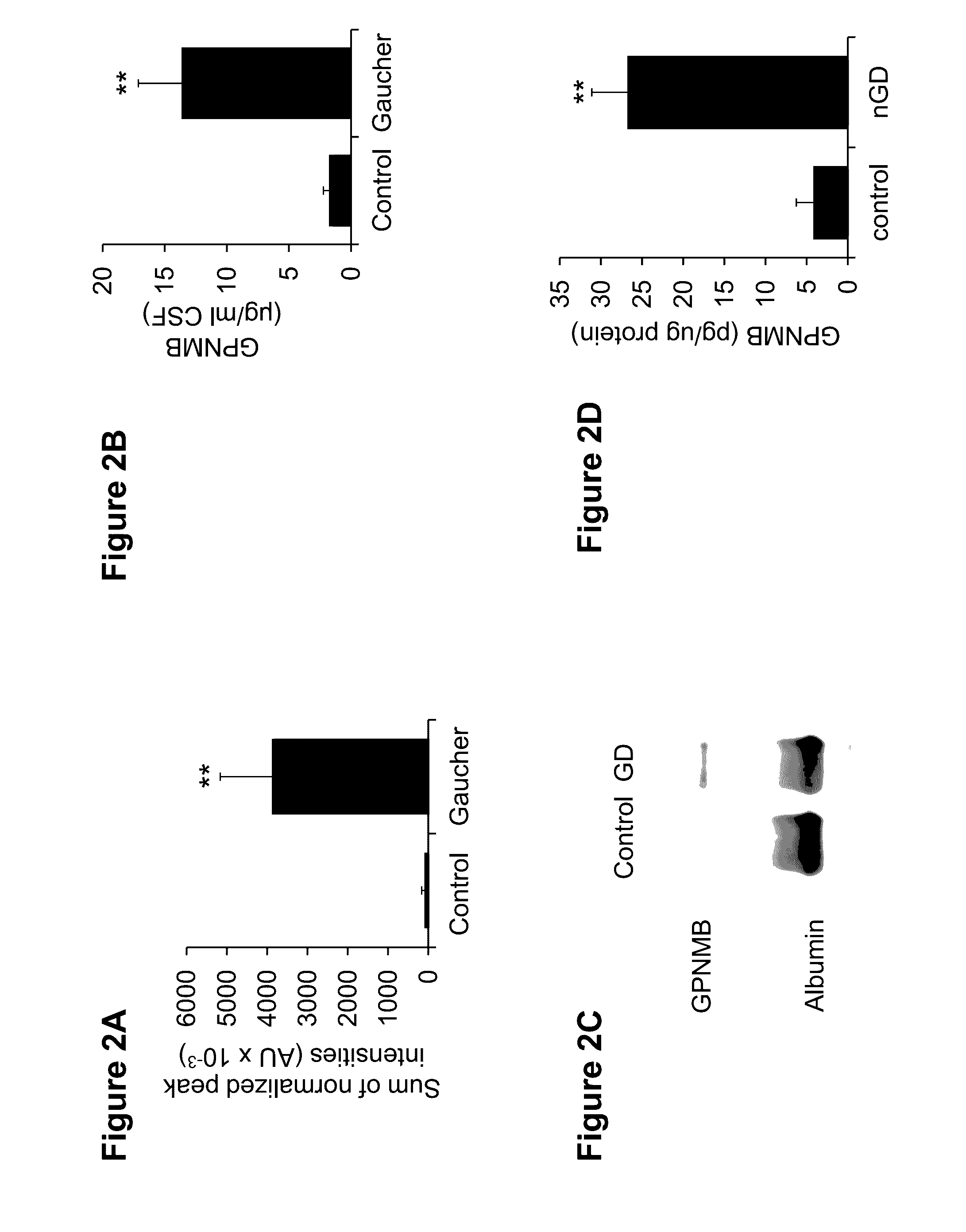 Marker of neuropathic gaucher's disease and methods of use thereof