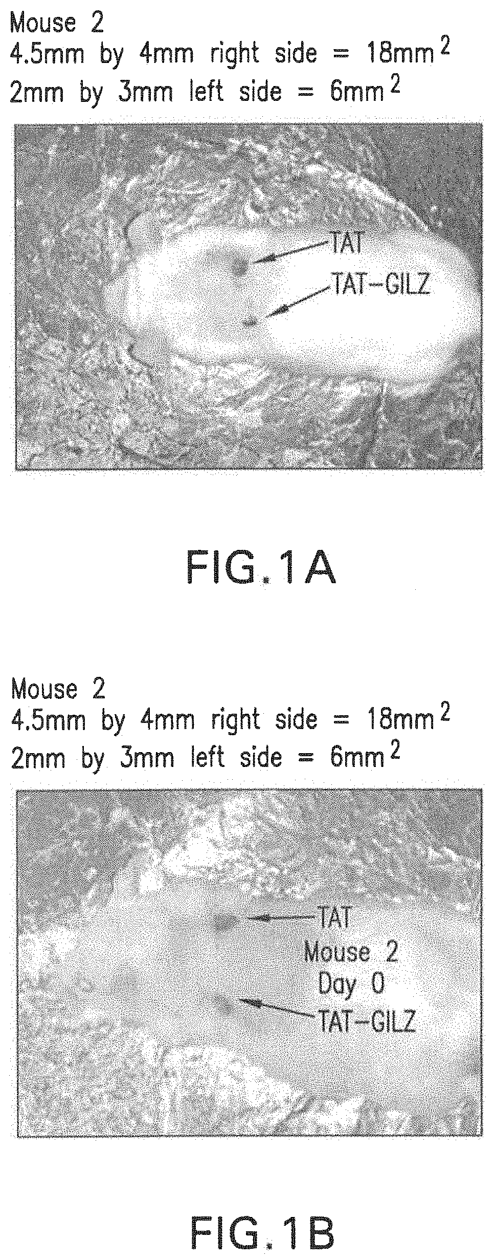 Gilz Formulations for Wound Healing