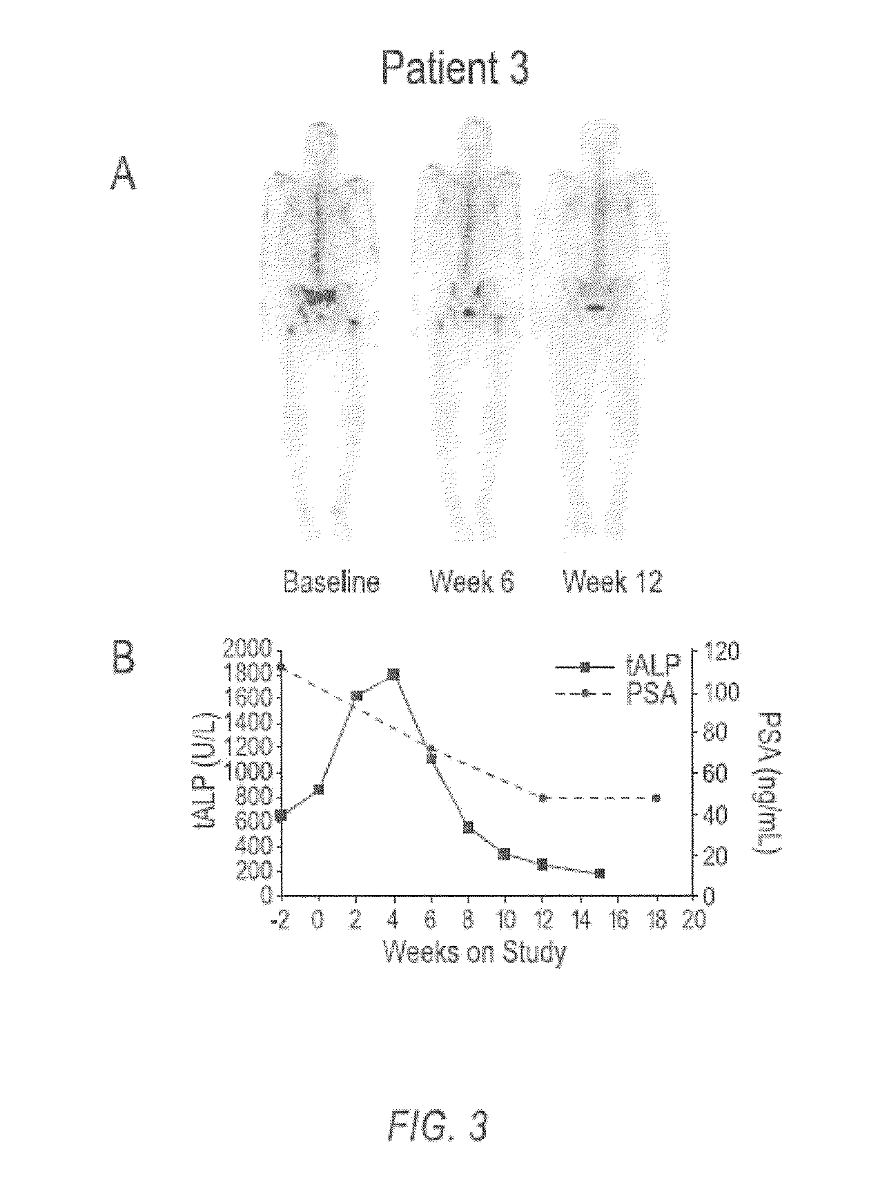 Method of Treating Cancer and Bone Cancer Pain
