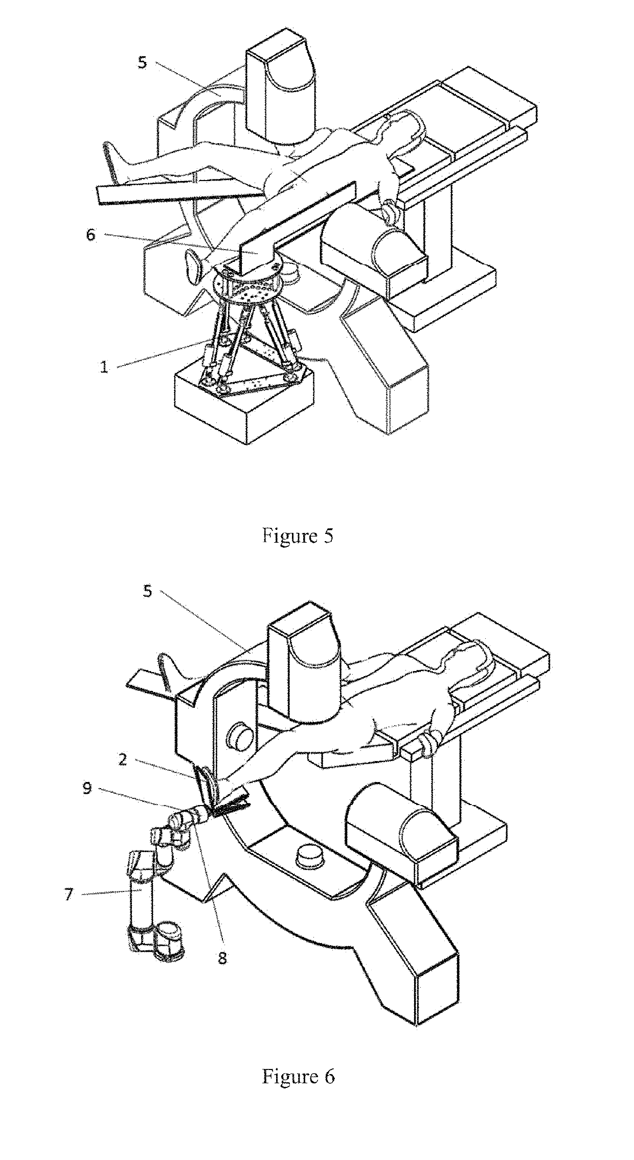 Remotely Operated Orthopedic Surgical Robot System for Fracture Reduction with Visual-servo Control Method