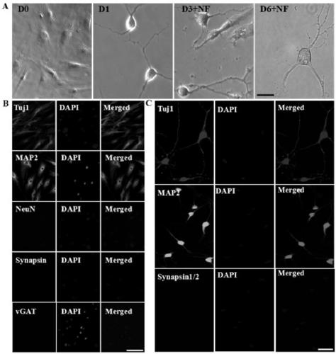 Neuronal precursor cells derived from adipose-derived stem cells and preparation method and application of neuronal precursor cells