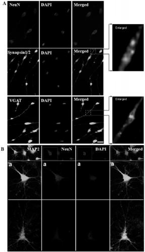 Neuronal precursor cells derived from adipose-derived stem cells and preparation method and application of neuronal precursor cells