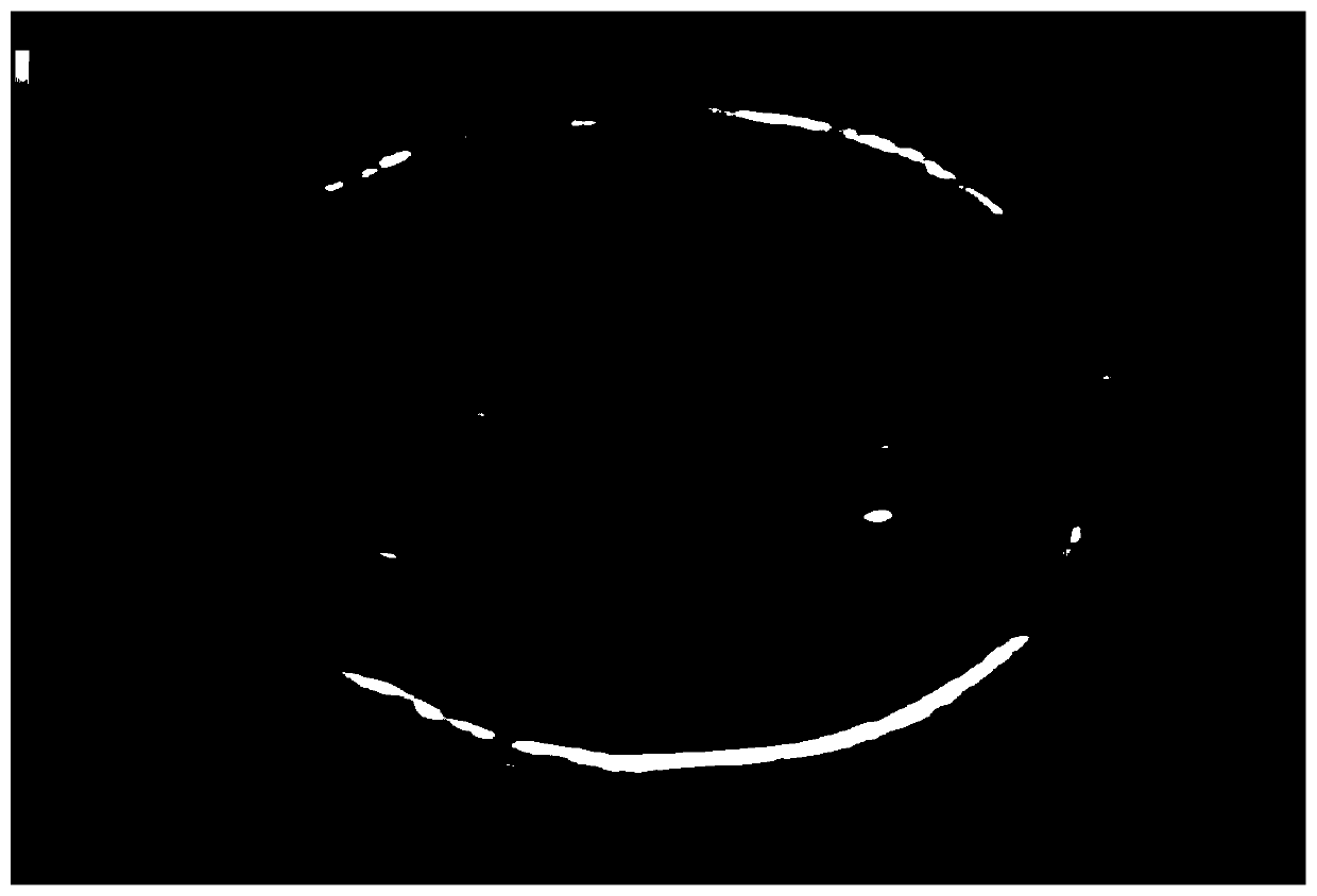 B-mode ultrasound image fetus head circumference detection method based on closed-loop shortest path