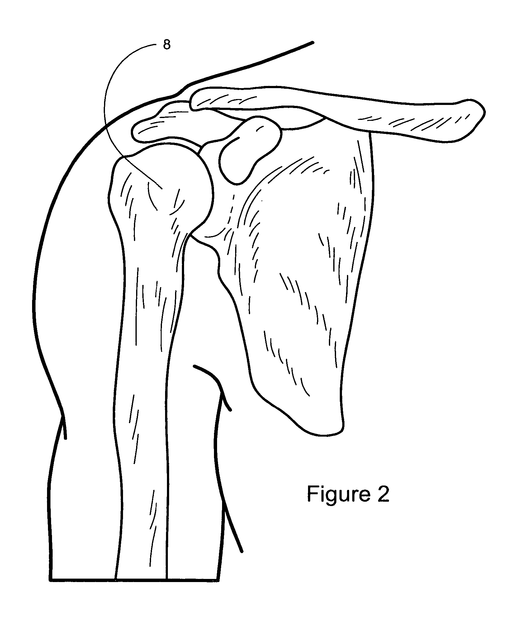 Biofidelic shoulder brace