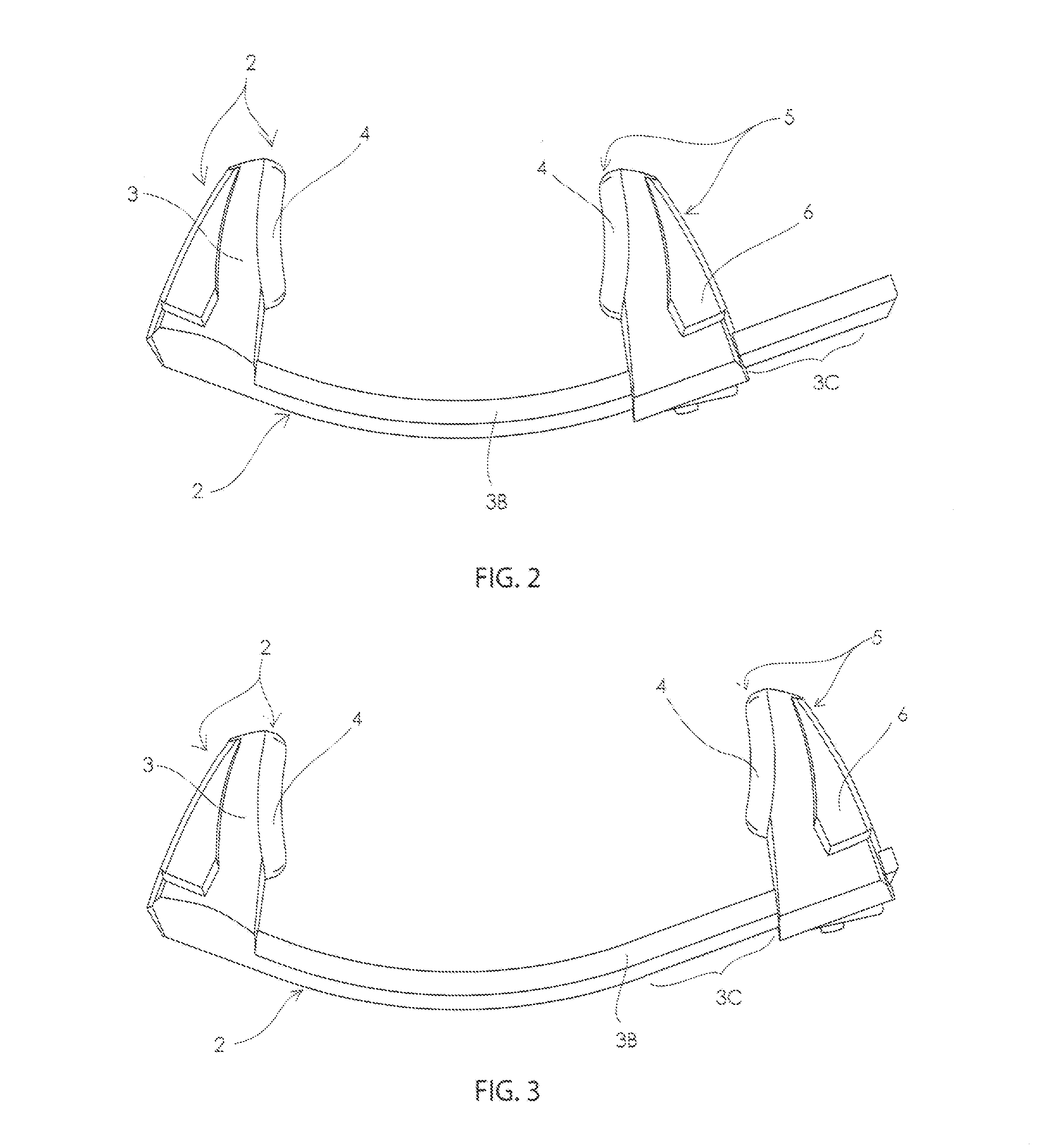 Apparatus for stabilization of pelvic fractures