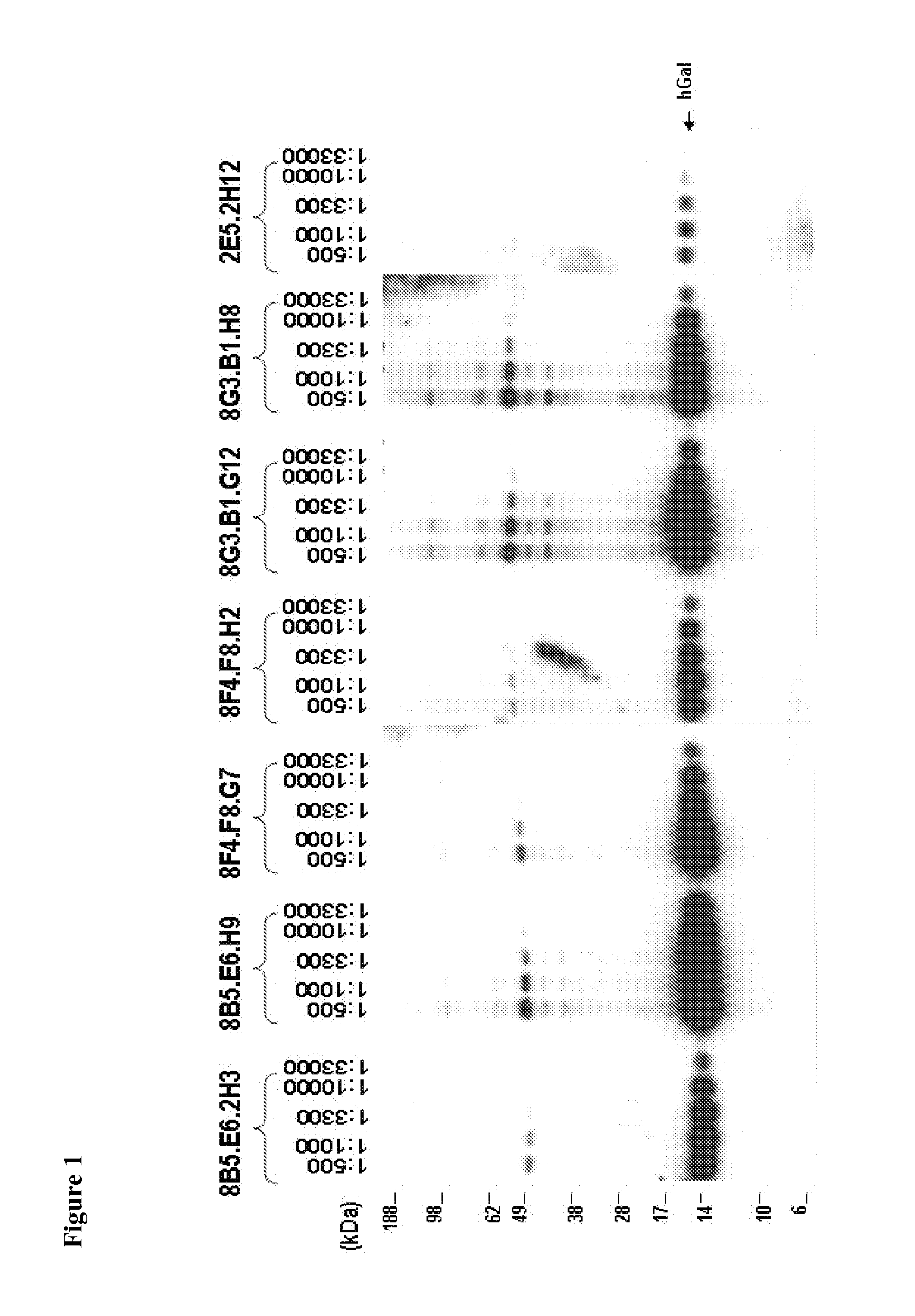 Compositions, kits, and methods for the diagnosis, prognosis, monitoring, treatment and modulation of post-transplant lymphoproliferative disorders and hypoxia associated angiogenesis disorders using galectin-1
