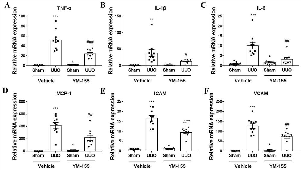 Application of YM-155 in medicine for preventing and treating chronic kidney disease