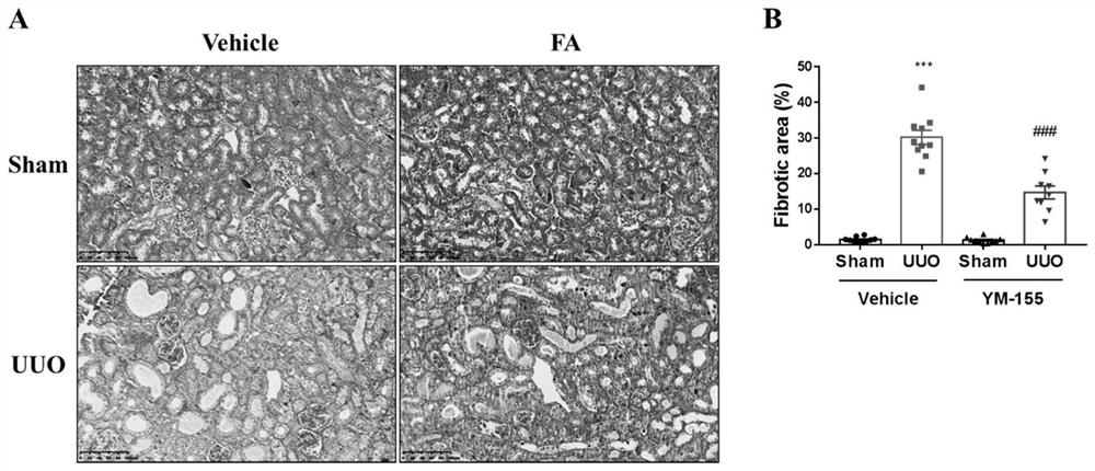 Application of YM-155 in medicine for preventing and treating chronic kidney disease