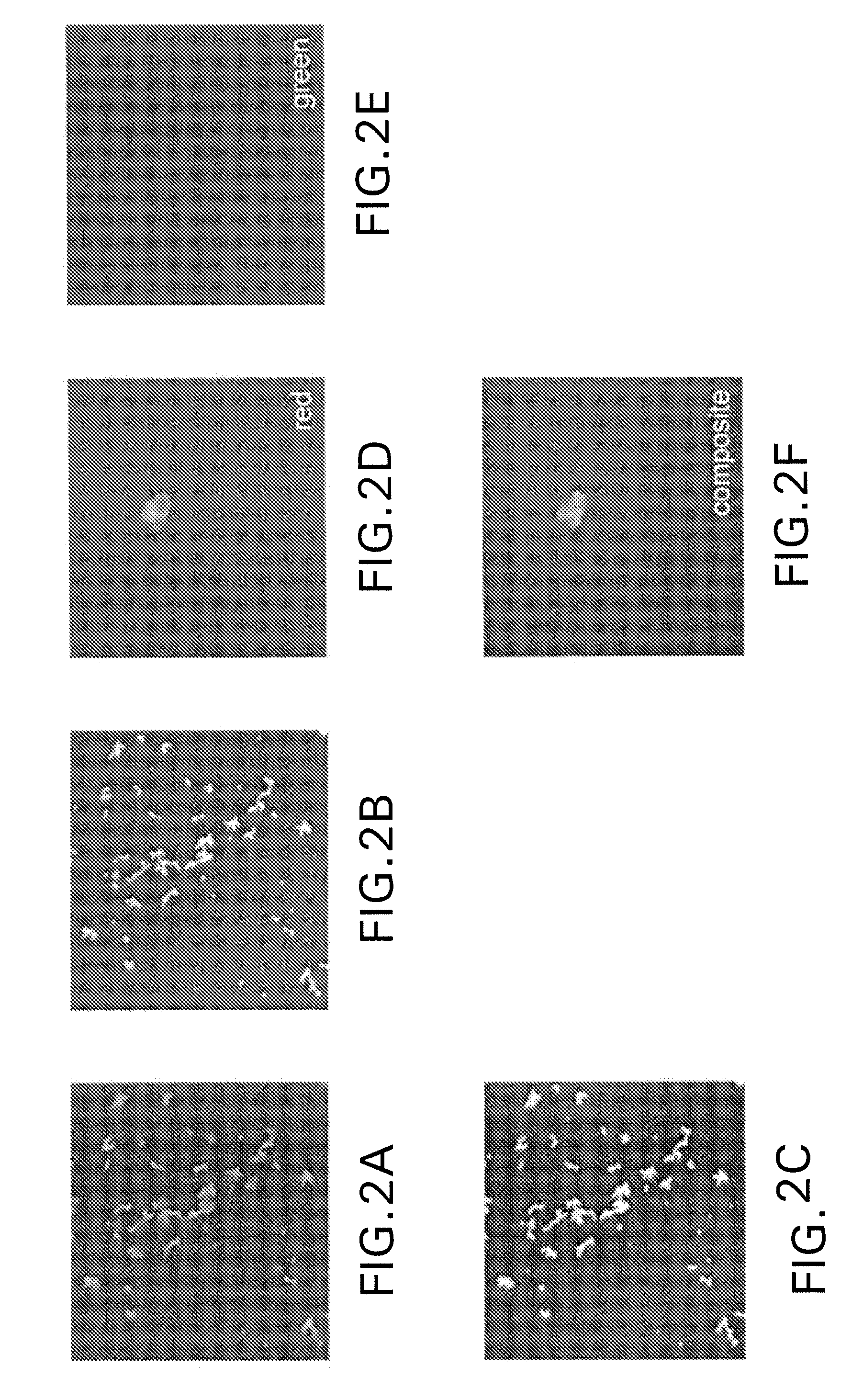 Methods and compositions for needleless delivery of particles