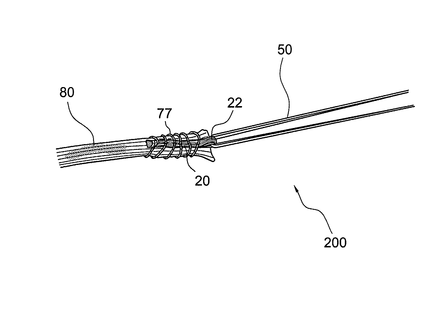 Methods of making reinforced soft grafts with suture loop/needle construct