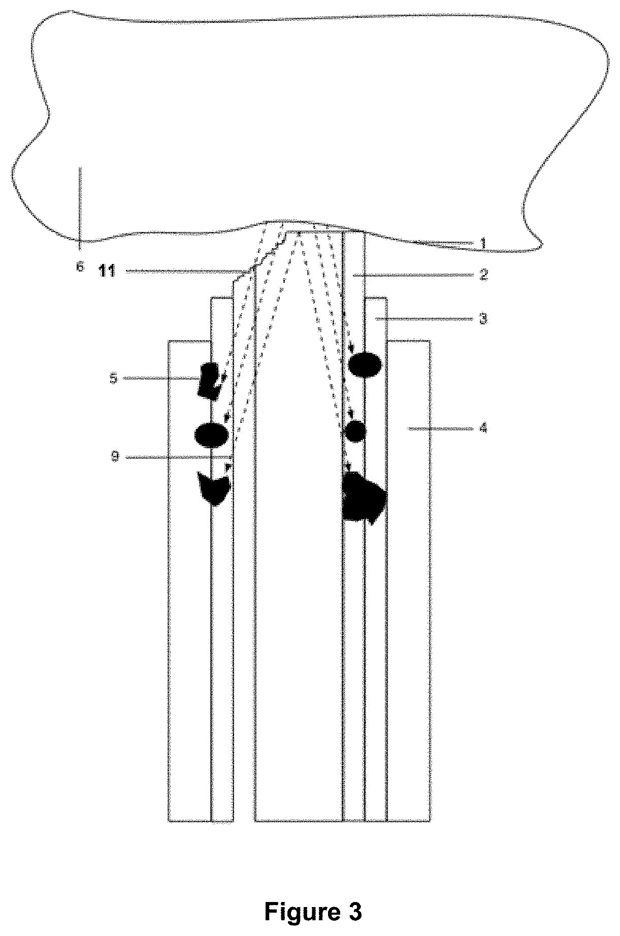 Arrangement for filtering out damaging heat created from laser energy contacting a kidney stone