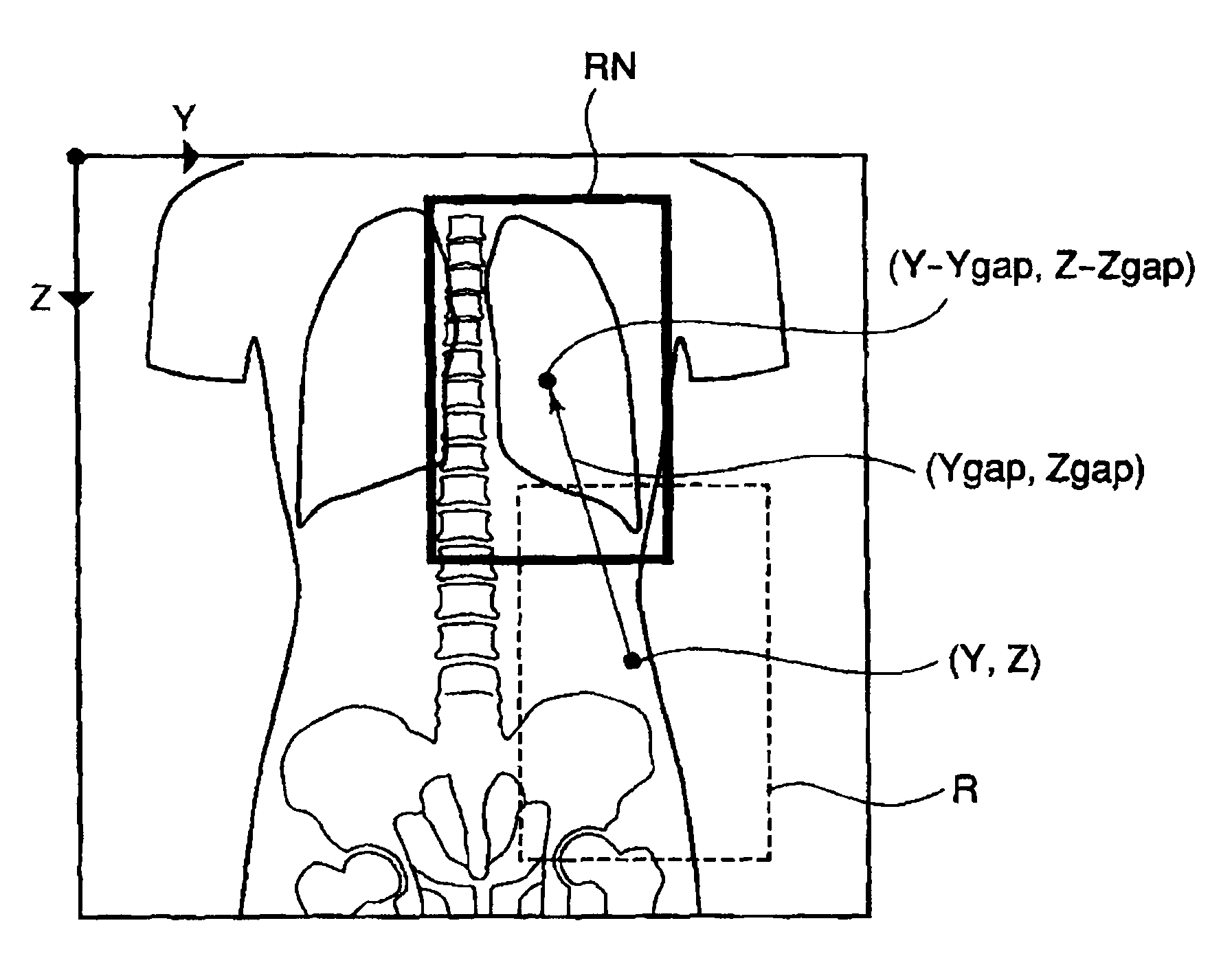 X-ray CT system and a method for creating a scanning plan