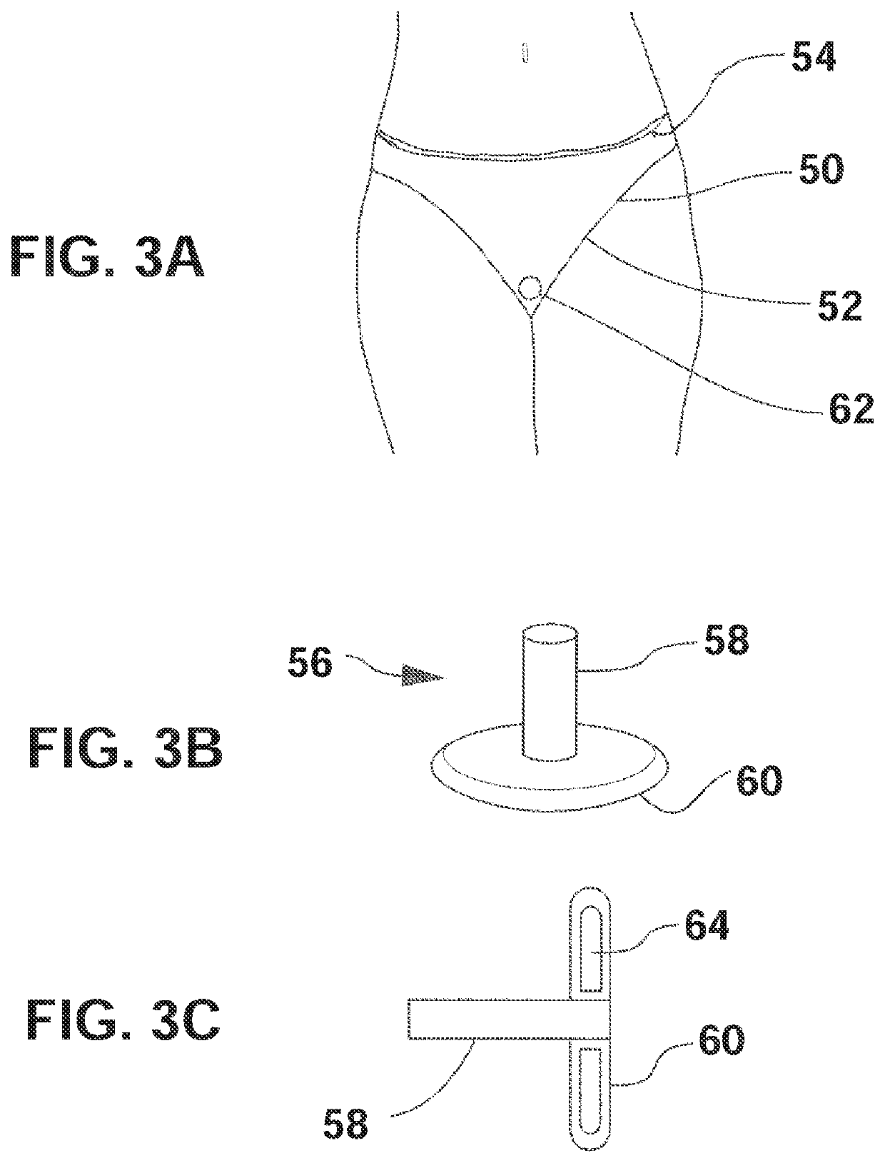 Wearable urinary collection apparatus