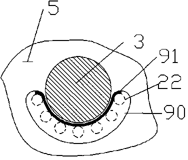 Nut protein extraction device with primary auxiliary teeth and feeding sensor